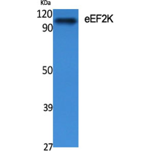 EEF2K Antibody - Western blot of eEF2K antibody