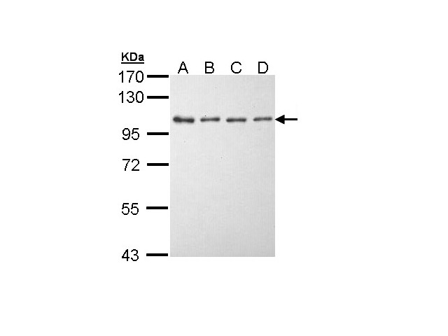 EEF2K Antibody - Sample (30 ug of whole cell lysate). A: A431 , B: H1299, C: Hela, D: Hep G2 . 7.5% SDS PAGE. EEF2K antibody diluted at 1:5000.