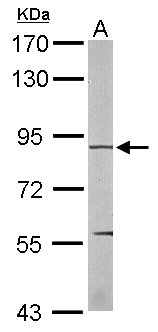 EEF2K Antibody - Sample (50 ug of whole cell lysate). A: mouse liver. 7.5% SDS PAGE. EEF2K antibody diluted at 1:1000.