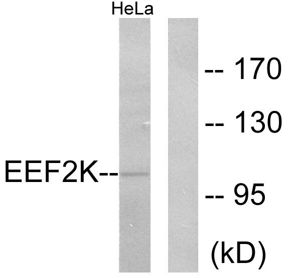 EEF2K Antibody - Western blot analysis of lysates from HeLa cells, treated with serum 10% 15', using eEF2K Antibody. The lane on the right is blocked with the synthesized peptide.