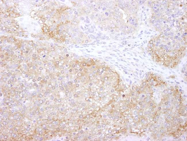 EEF2K Antibody - Detection of Mouse eEF2 Kinase by Immunohistochemistry. Sample: FFPE section of mouse teratoma. Antibody: Affinity purified rabbit anti-eEF2 Kinase used at a dilution of 1:250.