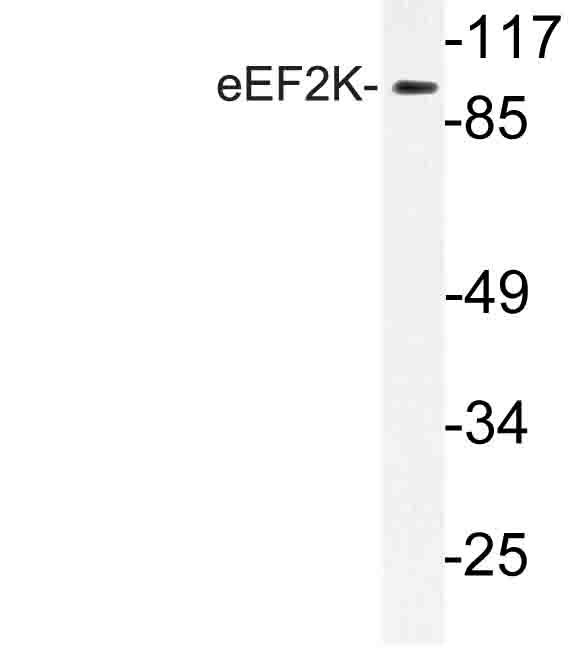 EEF2K Antibody - Western blot of eEF2K (G358) pAb in extracts from Jurkat cells.