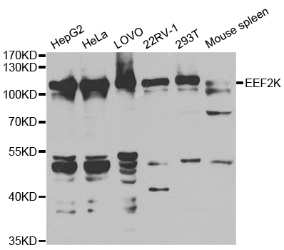 EEF2K Antibody - Western blot analysis of extracts of various cell lines.