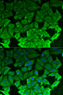 EEF2K Antibody - Immunofluorescence analysis of MCF-7 cells.