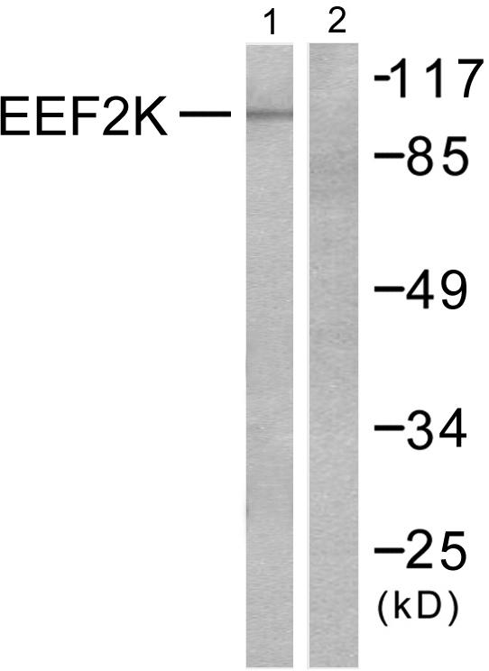 EEF2K Antibody - Western blot analysis of extracts from Hela cells treated with serum (10%, 15mins), using eEF2K (Ab-366) antibody ( Line 1 and 2).