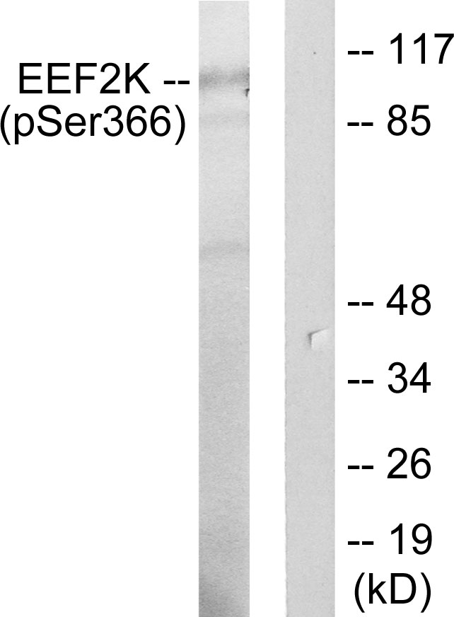 EEF2K Antibody - Western blot analysis of lysates from HeLa cells treated with serum 10% 15', using eEF2K (Phospho-Ser366) Antibody. The lane on the right is blocked with the phospho peptide.