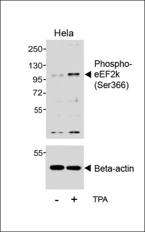 EEF2K Antibody - Western blot analysis of lysates from Hela cell line, untreated or treated with TPA, 200nM, using (upper) or Beta-actin (lower).