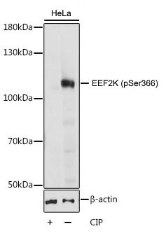 EEF2K Antibody - Western blot analysis of HeLa cell lysate untreated or treated with CIP using Rabbit anti EEF2K antibody at a 1/1000 dilution. Cells were cultured in serum free media overnight before treatment with CIP at 37°C for 1 hour. 3% BSA was used for blocking.