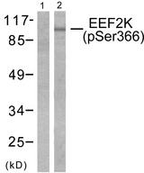 EEF2K Antibody - Western blot analysis of extracts from Hela cells treated with serum (10%, 15mins), using eEF2K (phospho-Ser366) antibody.