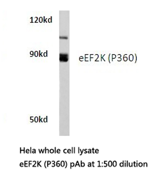 EEF2K Antibody - Western blot of eEF2K (P360) pAb in extracts from HeLa cells.
