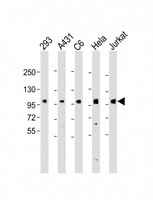 EEF2K Antibody - All lanes: Anti-EEF2k Antibody at 1:2000 dilution Lane 1: 293 whole cell lysate Lane 2: A431 whole cell lysate Lane 3: C6 whole cell lysate Lane 4: Hela whole cell lysate Lane 5: Jurkat whole cell lysate Lysates/proteins at 20 µg per lane. Secondary Goat Anti-Rabbit IgG, (H+L), Peroxidase conjugated at 1/10000 dilution. Predicted band size: 82 kDa Blocking/Dilution buffer: 5% NFDM/TBST.