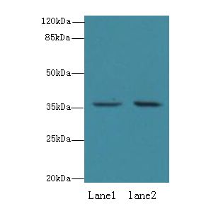 EEF2KMT / FAM86A Antibody - Western blot. All lanes: EEF2KMT antibody at 6 ug/ml. Lane 1: HeLa whole cell lysate. Lane 2: 293T whole cell lysate. Secondary Goat polyclonal to Rabbit IgG at 1:10000 dilution. Predicted band size: 37 kDa. Observed band size: 37 kDa.