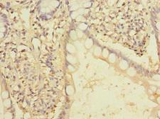 EEF2KMT / FAM86A Antibody - Immunohistochemistry of paraffin-embedded human small intestine tissue using EEF2KMT Antibody at dilution of 1:100