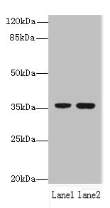 EEF2KMT / FAM86A Antibody - Western blot All lanes: EEF2KMT antibody at 6µg/ml Lane 1: Hela whole cell lysate Lane 2: 293T whole cell lysate Secondary Goat polyclonal to rabbit IgG at 1/10000 dilution Predicted band size: 37, 34 kDa Observed band size: 37 kDa