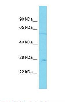EEF2KMT / FAM86A Antibody - Western blot of Human THP-1. FAM86A antibody dilution 1.0 ug/ml.  This image was taken for the unconjugated form of this product. Other forms have not been tested.