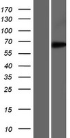 EEFSEC / EFSEC Protein - Western validation with an anti-DDK antibody * L: Control HEK293 lysate R: Over-expression lysate