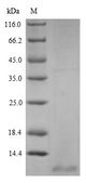 NPPC Protein - (Tris-Glycine gel) Discontinuous SDS-PAGE (reduced) with 5% enrichment gel and 15% separation gel.
