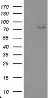 EEYORE / TIGD1 Antibody - HEK293T cells were transfected with the pCMV6-ENTRY control (Left lane) or pCMV6-ENTRY TIGD1 (Right lane) cDNA for 48 hrs and lysed. Equivalent amounts of cell lysates (5 ug per lane) were separated by SDS-PAGE and immunoblotted with anti-TIGD1.