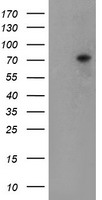 EEYORE / TIGD1 Antibody - HEK293T cells were transfected with the pCMV6-ENTRY control (Left lane) or pCMV6-ENTRY TIGD1 (Right lane) cDNA for 48 hrs and lysed. Equivalent amounts of cell lysates (5 ug per lane) were separated by SDS-PAGE and immunoblotted with anti-TIGD1.
