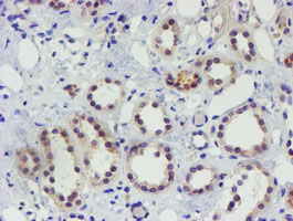 EEYORE / TIGD1 Antibody - IHC of paraffin-embedded Human Kidney tissue using anti-TIGD1 mouse monoclonal antibody. (Heat-induced epitope retrieval by 10mM citric buffer, pH6.0, 100C for 10min).