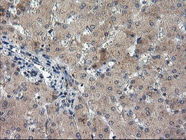 EEYORE / TIGD1 Antibody - IHC of paraffin-embedded Human liver tissue using anti-TIGD1 mouse monoclonal antibody. (Heat-induced epitope retrieval by 10mM citric buffer, pH6.0, 100C for 10min).