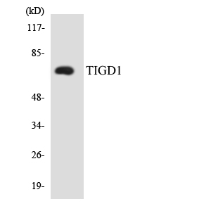 EEYORE / TIGD1 Antibody - Western blot analysis of the lysates from HeLa cells using TIGD1 antibody.
