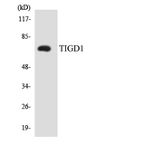 EEYORE / TIGD1 Antibody - Western blot analysis of the lysates from HeLa cells using TIGD1 antibody.