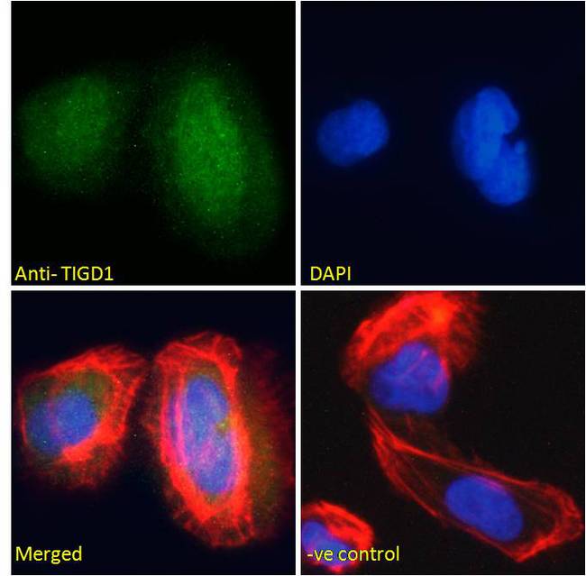 EEYORE / TIGD1 Antibody - EEYORE / TIGD1 antibody immunofluorescence analysis of paraformaldehyde fixed U2OS cells, permeabilized with 0.15% Triton. Primary incubation 1hr (10ug/ml) followed by Alexa Fluor 488 secondary antibody (2ug/ml), showing nuclear staining. Actin filaments were stained with phalloidin (red) and The nuclear stain is DAPI (blue). Negative control: Unimmunized goat IgG (10ug/ml) followed by Alexa Fluor 488 secondary antibody (2ug/ml).