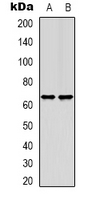 EEYORE / TIGD1 Antibody - Western blot analysis of TIGD1 expression in HEK293T (A); HeLa (B) whole cell lysates.
