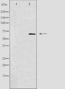 EEYORE / TIGD1 Antibody - Western blot analysis of extracts of 293 cells using TIGD1 antibody. The lane on the left is treated with the antigen-specific peptide.