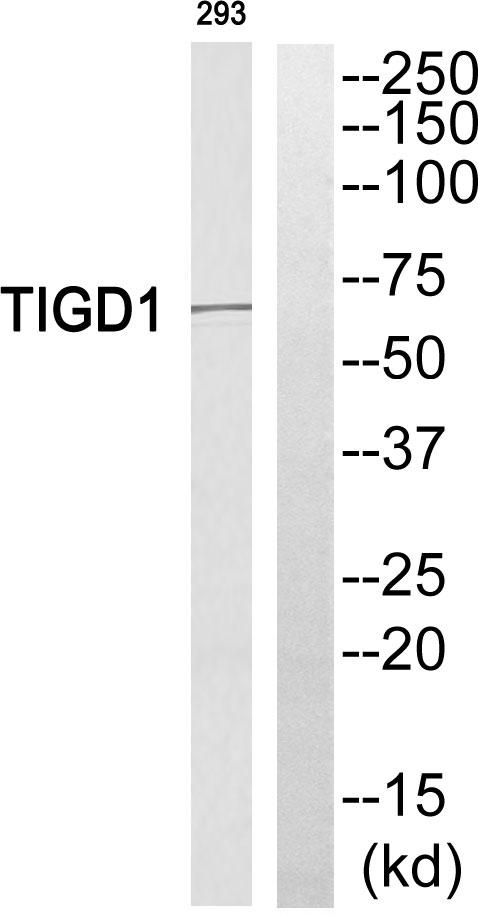 EEYORE / TIGD1 Antibody - Western blot analysis of extracts from 293 cells, using TIGD1 antibody.