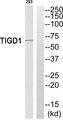 EEYORE / TIGD1 Antibody - Western blot analysis of extracts from 293 cells, using TIGD1 antibody.