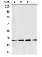EF1B / EEF1B2 Antibody - Western blot analysis of EEF1B2 expression in Jurkat (A); HeLa (B); MCF7 (C); A431 (D) whole cell lysates.