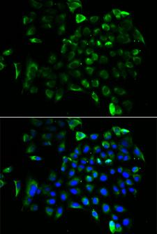 EF1B / EEF1B2 Antibody - Immunofluorescence analysis of A549 cells.