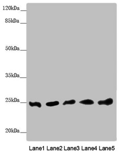 EF1B / EEF1B2 Antibody - Western blot All Lanes: EEF1B2 antibody at 0.91 ug/ml Lane 1: PC-3 whole cell lysate Lane 2: 293T whole cell lysate Lane 3: Hela whole cell lysate Lane 4: Jurkat whole cell lysate Lane 5: Raw264.7 whole cell lysate Secondary Goat polyclonal to rabbit IgG at 1/10000 dilution Predicted band size: 25 kDa Observed band size: 25 kDa