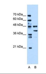 EF1G / EEF1G Antibody - Lane A: Marker. Lane B: Jurkat cell lysate. Antibody concentration: 0.25 ug/ml. Gel concentration: 12%.  This image was taken for the unconjugated form of this product. Other forms have not been tested.