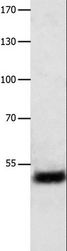 EF1G / EEF1G Antibody - Western blot analysis of Human liver cancer tissue, using EEF1G Polyclonal Antibody at dilution of 1:800.