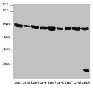 EF1G / EEF1G Antibody - Western blot All Lanes:EEF1G antibody at 0.73 ug/ml Lane 1: Mouse gonadal tissue Lane 2: Mouse brain tissue Lane 3: HL60 whole cell lysate Lane 4: NIH/3T3 whole cell lysate Lane 5: PC-3 whole cell lysate Lane 6: HepG-2 whole cell lysate Lane 7: Hela whole cell lysate Lane 8: 293T whole cell lysate Lane 9: Raw264.7 whole cell lysate Secondary Goat polyclonal to rabbit IgG at 1/10000 dilution Predicted band size: 51,57 kDa Observed band size: 50,19 kDa