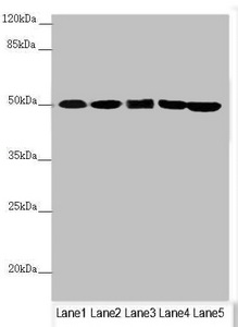 EF1G / EEF1G Antibody - Western blot All Lanes:EEF1G antibody at 0.78 ug/ml Lane 1: Mouse gonadal tissue Lane 2: PC-3 whole cell lysate Lane 3: HepG-2 whole cell lysate Lane 4: Hela whole cell lysate Lane 5: 293T whole cell lysate Secondary Goat polyclonal to rabbit IgG at 1/10000 dilution Predicted band size: 51,57 kDa Observed band size: 50 kDa