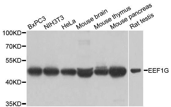 EF1G / EEF1G Antibody - Western blot analysis of extracts of various cell lines, using EEF1G antibody at 1:1000 dilution. The secondary antibody used was an HRP Goat Anti-Rabbit IgG (H+L) at 1:10000 dilution. Lysates were loaded 25ug per lane and 3% nonfat dry milk in TBST was used for blocking. An ECL Kit was used for detection and the exposure time was 5s.