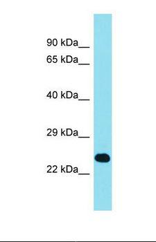 EFCAB1 Antibody - Western blot of Human RPMI-8226. EFCAB1 antibody dilution 1.0 ug/ml.  This image was taken for the unconjugated form of this product. Other forms have not been tested.