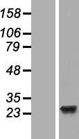 EFCAB1 Protein - Western validation with an anti-DDK antibody * L: Control HEK293 lysate R: Over-expression lysate