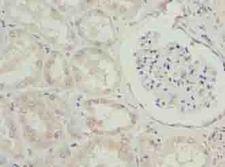 EFCAB12 / C3orf25 Antibody - Immunohistochemistry of paraffin-embedded human kidney tissue using antibody at dilution of 1:100.