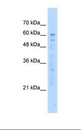 EFCAB14 Antibody - HepG2 cell lysate. Antibody concentration: 5.0 ug/ml. Gel concentration: 12%.  This image was taken for the unconjugated form of this product. Other forms have not been tested.
