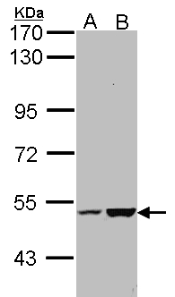 EFCAB14 Antibody - Sample (30 ug of whole cell lysate). A: Molt-4 , B: Raji. 7.5% SDS PAGE. KIAA0494 antibody diluted at 1:1000.