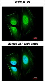 EFCAB14 Antibody - Immunofluorescence of paraformaldehyde-fixed HeLa using KIAA0494 antibody at 1:200 dilution.