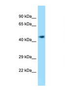 EFCAB14 Antibody - 4732418C07Rik antibody Western blot of Mouse Liver lysate. Antibody concentration 1 ug/ml.  This image was taken for the unconjugated form of this product. Other forms have not been tested.