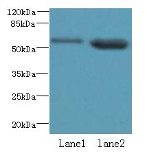 EFCAB14 Antibody - Western blot. All lanes: EFCAB14 antibody at 4 ug/ml. Lane 1: Colo320 whole cell lysate. Lane 2: HeLa whole cell lysate. Secondary Goat polyclonal to Rabbit IgG at 1:10000 dilution. Predicted band size: 55 kDa. Observed band size: 55 kDa.