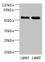 EFCAB14 Antibody - Western blot All lanes: EFCAB14 antibody at 4µg/ml Lane 1: Colo320 whole cell lysate Lane 2: Hela whole cell lysate Secondary Goat polyclonal to rabbit IgG at 1/10000 dilution Predicted band size: 55 kDa Observed band size: 55 kDa