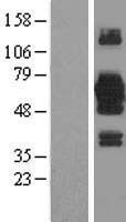 EFCAB14 Protein - Western validation with an anti-DDK antibody * L: Control HEK293 lysate R: Over-expression lysate
